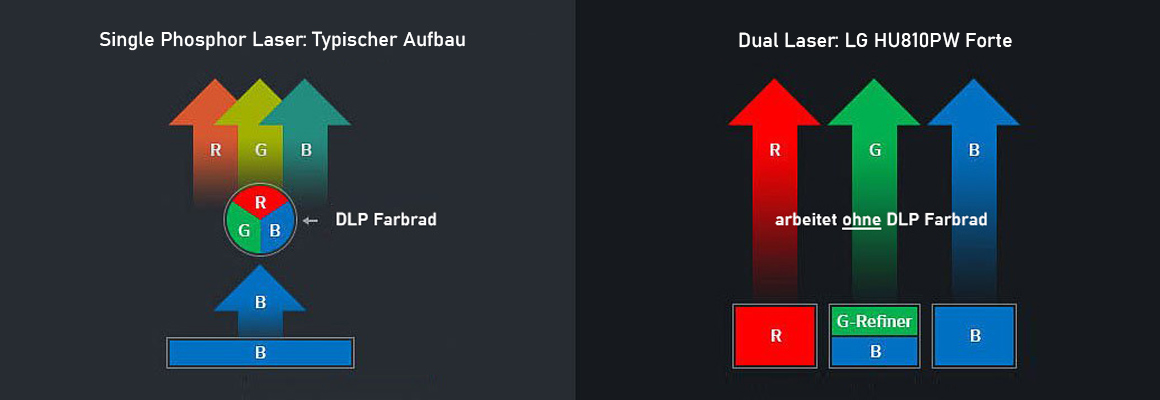 LG Forte Laser Aufbau Vorteil